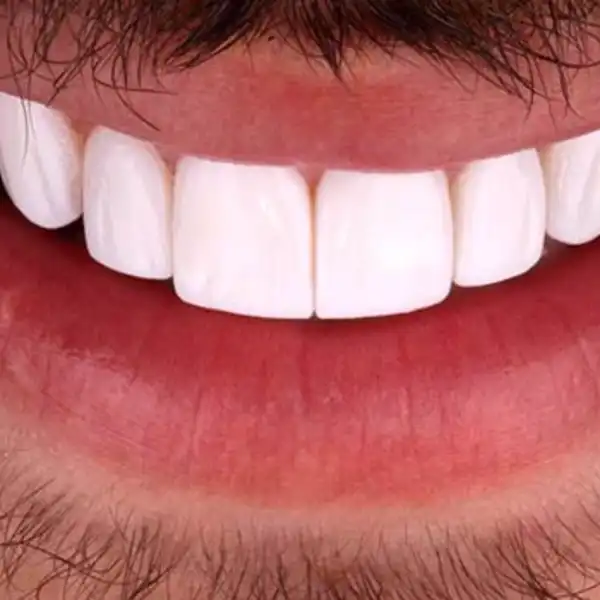 aWekc8uTsnZU8phpz8QxDNSqa0RlUdBd8ooXpqWEqFd2UCFh3l.jpg