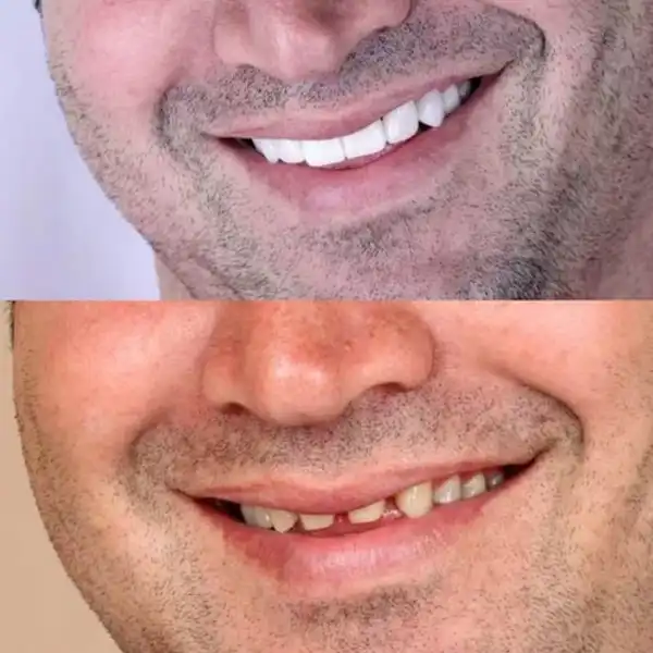 TSfqM0LYLiAFU38HPvjBIhLtiBXLXc1YXvqWFq7k7eQkTK8xpK.jpg